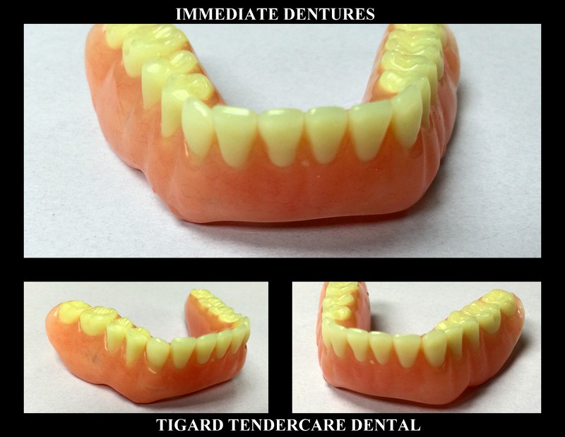 Tigard Dentures